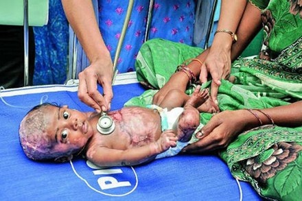 Em be co lan da tu phat ra khi gas gay chay hinh anh