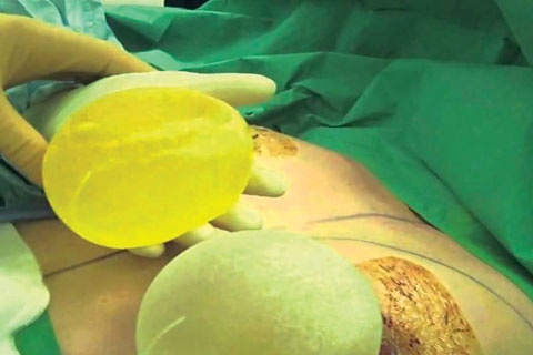 Anh cam nang nguc mien phi cho phu nu hinh anh