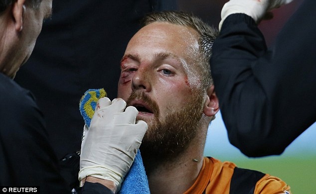 Koscielny khien doi phuong chay mau sau cu giam len mat hinh anh