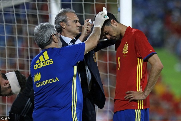 Trận ĐT Tây Ban Nha vs ĐT Georgia ảnh 7 Tran DT Tay Ban Nha vs DT Georgia anh 7