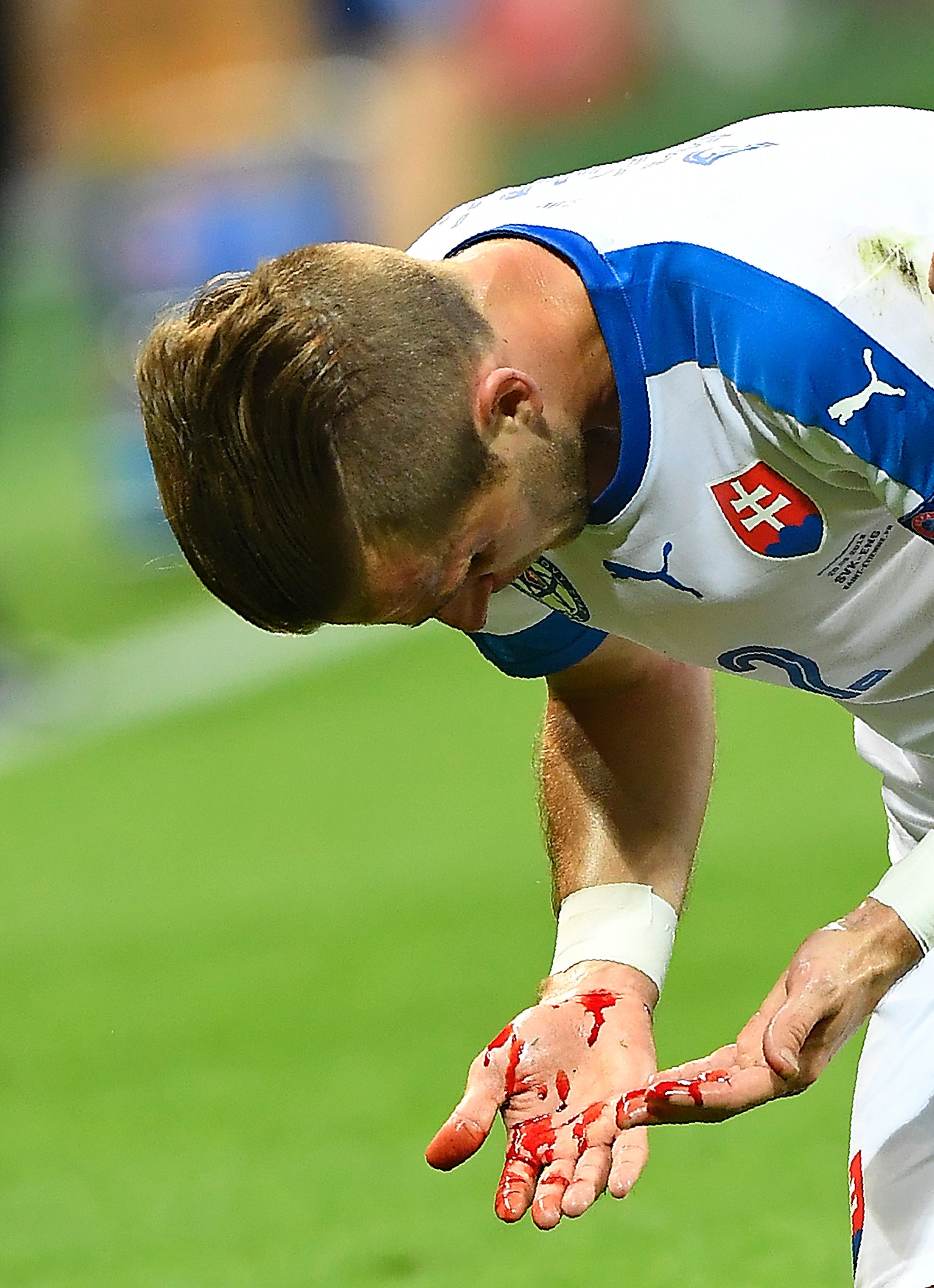 Cau thu do mau trong tran gap Anh anh 4