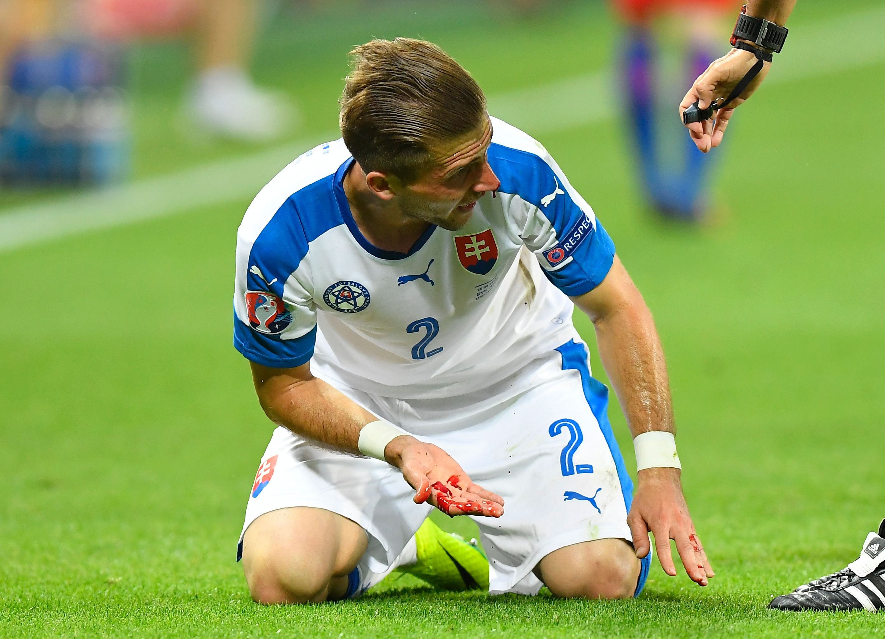 Cau thu do mau trong tran gap Anh anh 3