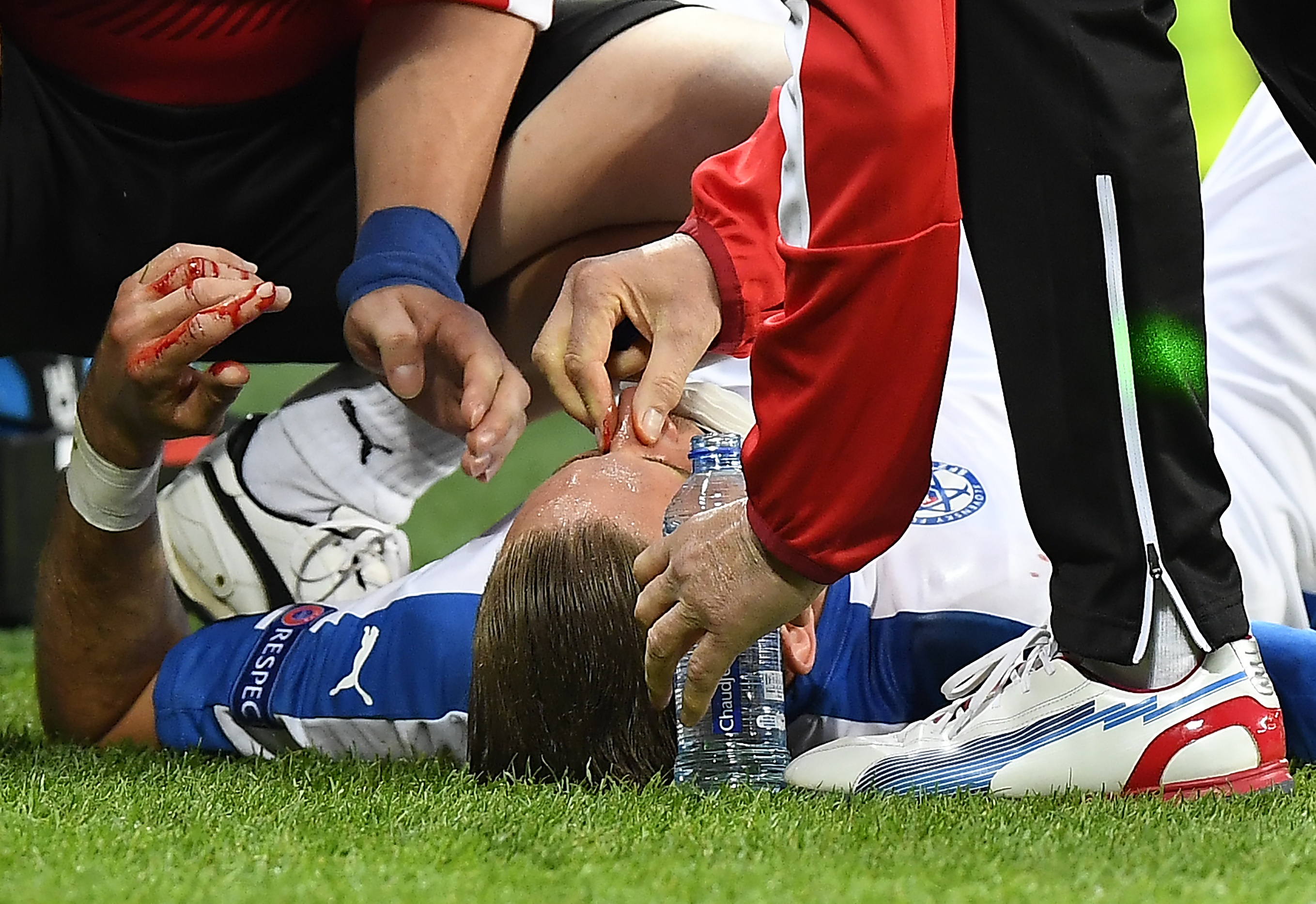 Cau thu do mau trong tran gap Anh anh 1