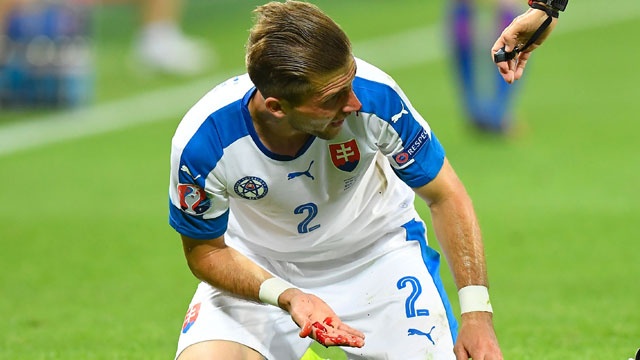 Cau thu do mau vi ve knock-out Euro 2016 hinh anh