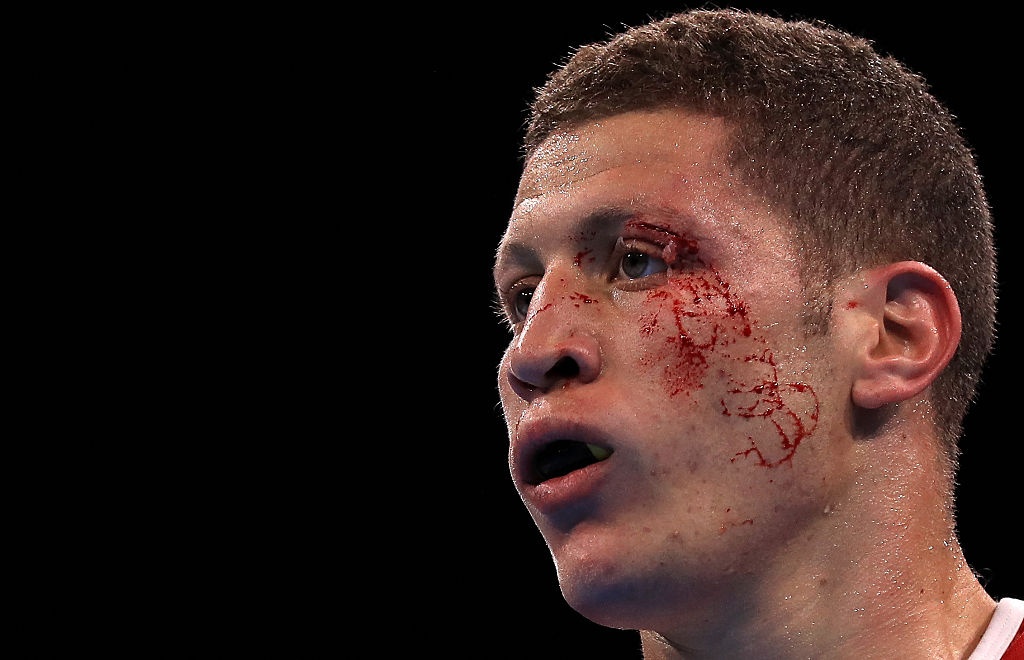 VĐV Algeria bị đánh rách mí mắt ảnh 2 VDV Algeria bi danh rach mi mat anh 2