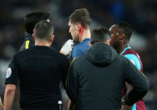 John Stones do mau trong tran thang 4-0 cua Man City hinh anh