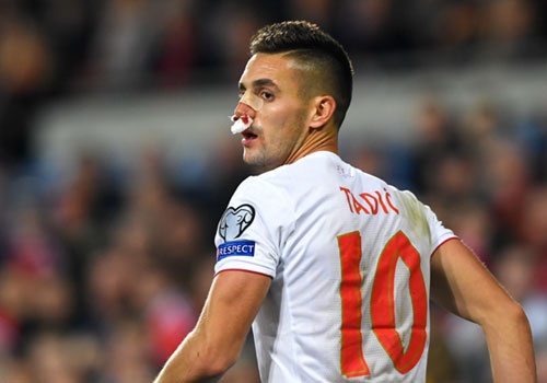 Tuyển thủ Serbia chấp nhận vỡ mũi ảnh 1 Tuyen thu Serbia chap nhan vo mui anh 1