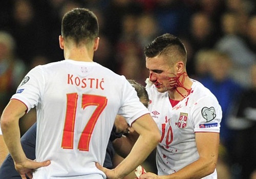 Tuyen thu Serbia chap nhan vo mui, gay chan vi World Cup hinh anh