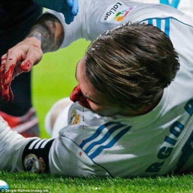 Ramos tuyen bo con do mau vi Real anh 1