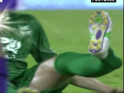 Cau thu bi gay gap chan sau pha vao bong kinh hoang hinh anh