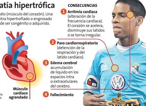 9 cai chet thuong tam cua cau thu bong da nam 2013 hinh anh