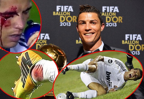 Ronaldo kho luyen, vuot qua chan thuong gianh Qua bong vang hinh anh