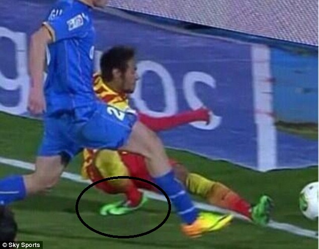 Chan thuong khung khiep khien Neymar lech mat ca chan hinh anh