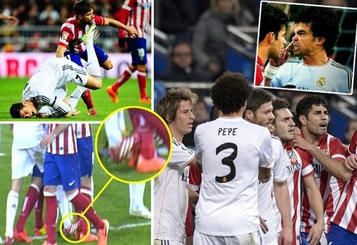 Bi Arbeloa dap nguoi, Diego Costa nhu noi dien hinh anh