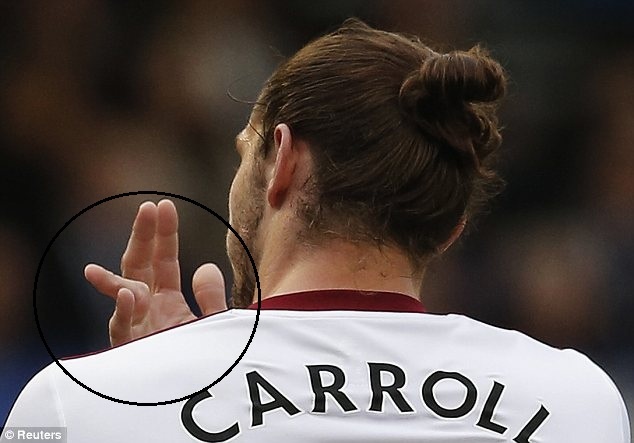 'Tham hoa kep' Andy Carroll gay gap ngon tay hinh anh