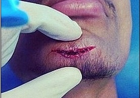 Cuu sao Chelsea rach toac cam trong buoi tap hinh anh