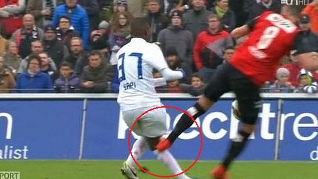 Pha vao bong lam rach day chang, vo xuong banh che doi thu hinh anh