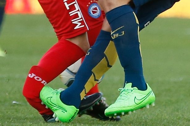 Tevez vao bong khien doi thu gay gap chan hinh anh