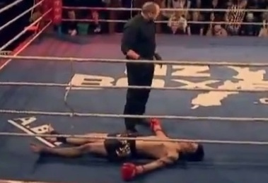 Vo si bi anh huong than kinh sau cu knock-out hinh anh