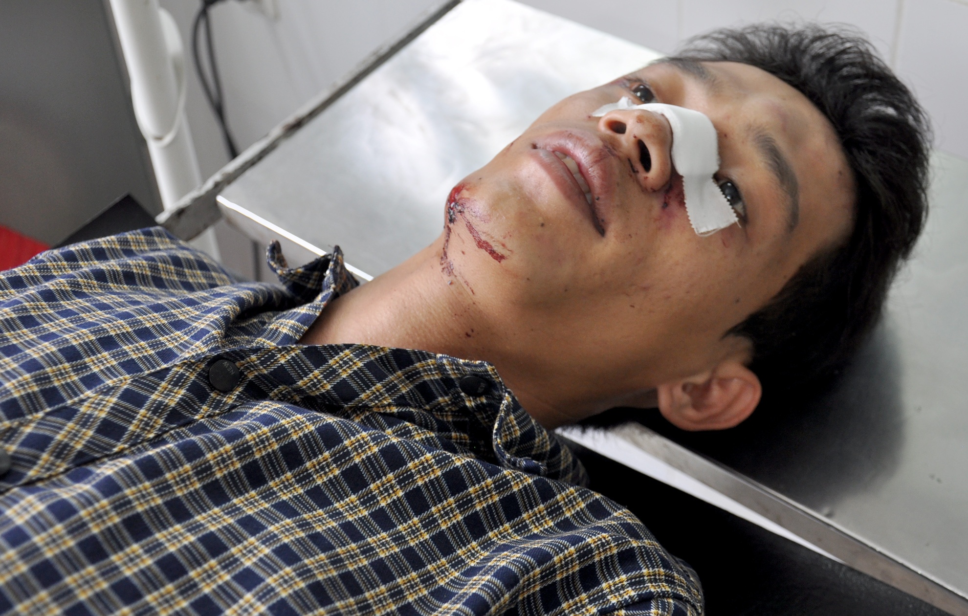 Vu xe khach va cham xe ben: Nhieu nan nhan nghi minh da chet hinh anh