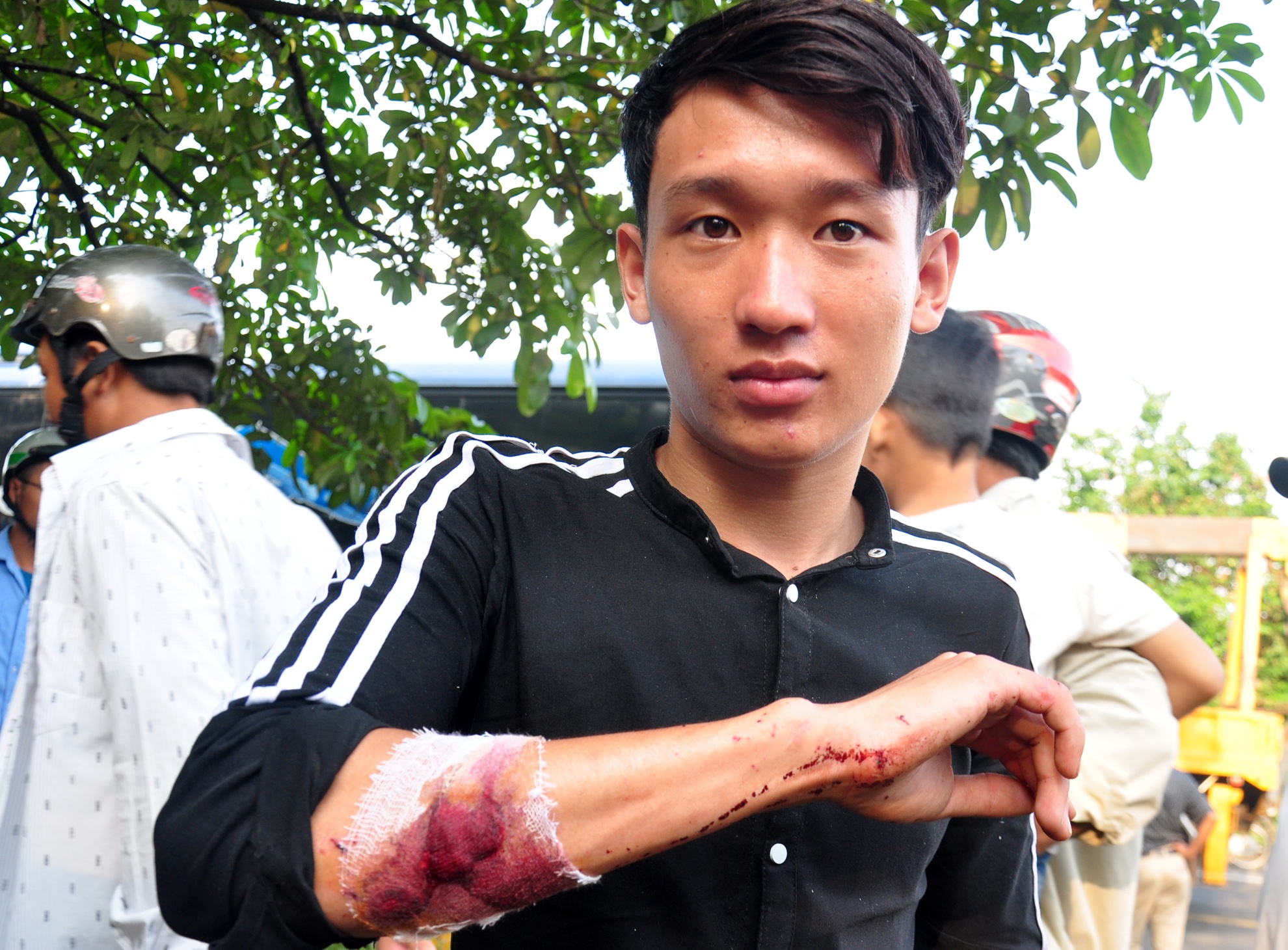 Loi ke cua nan nhan bi hat vang xuong duong trong vu oto khach dam truc dien xe tai hinh anh