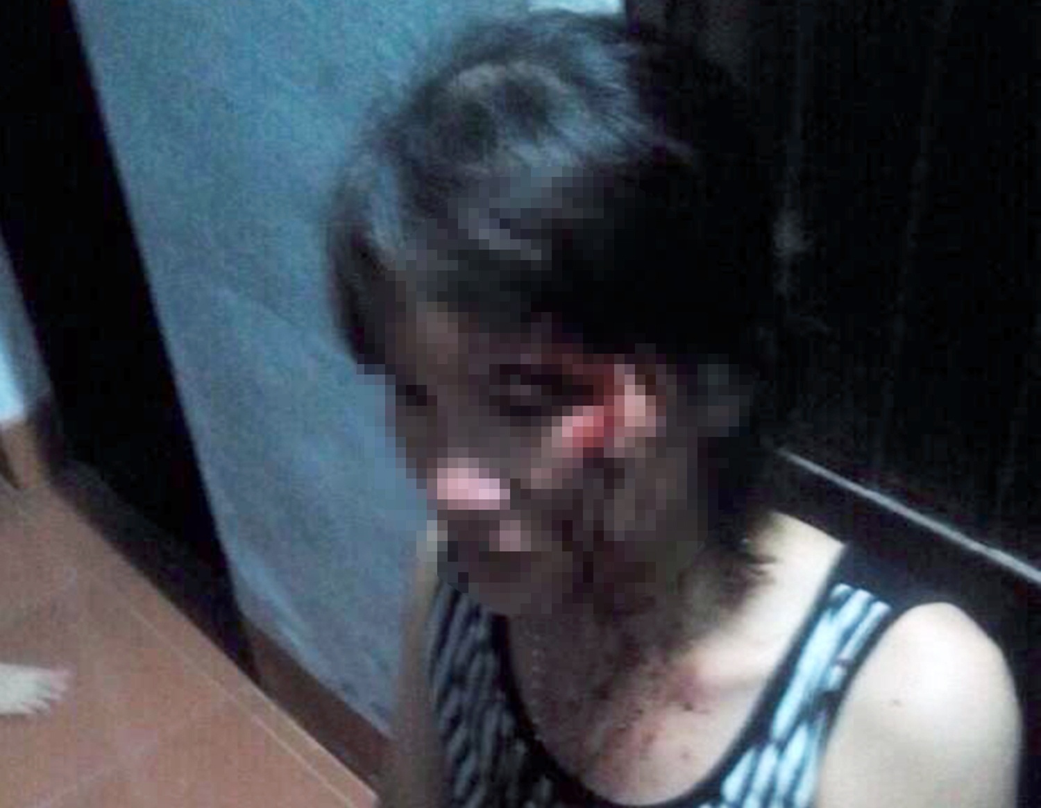 Bi chong danh bang tuyp sat, vo say thai hinh anh