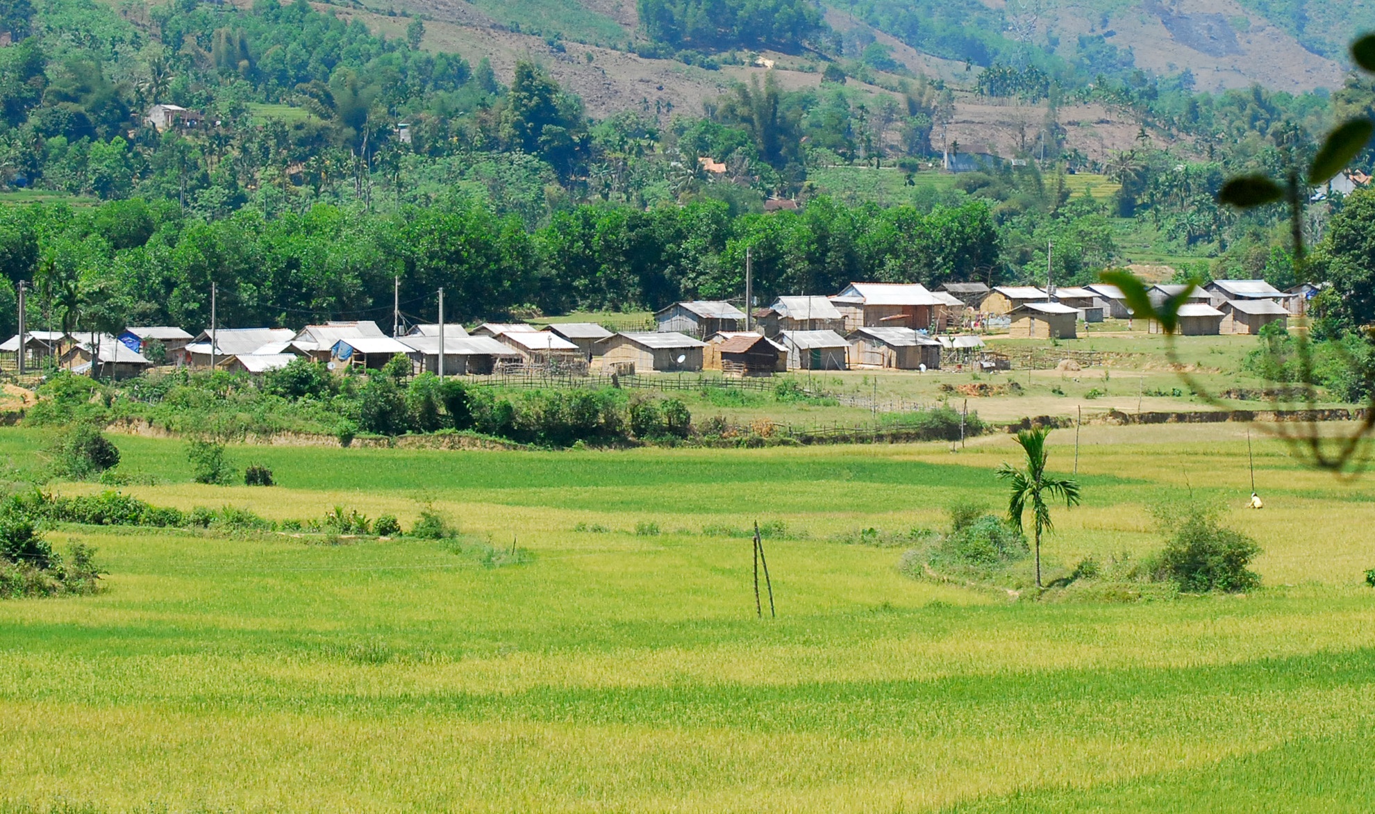 Hai bệnh nhân viêm da dày sừng bàn tay, bàn chân sử dụng gạo mốc ảnh 3 Hai benh nhan viem da day sung ban tay, ban chan su dung gao moc anh 3