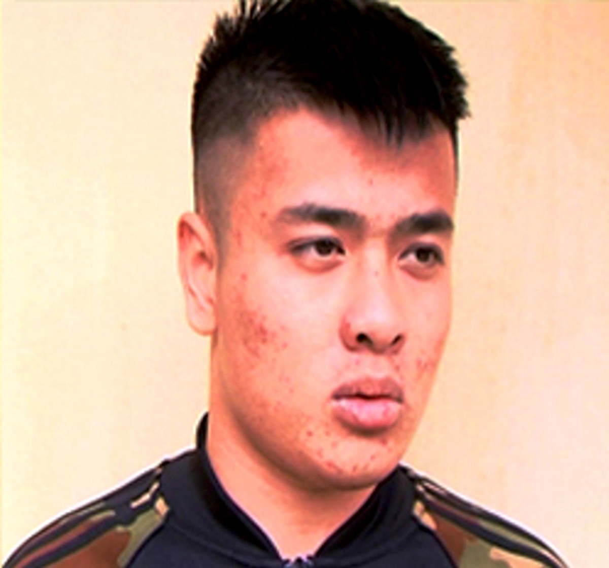 Bit mat no sung anh 2