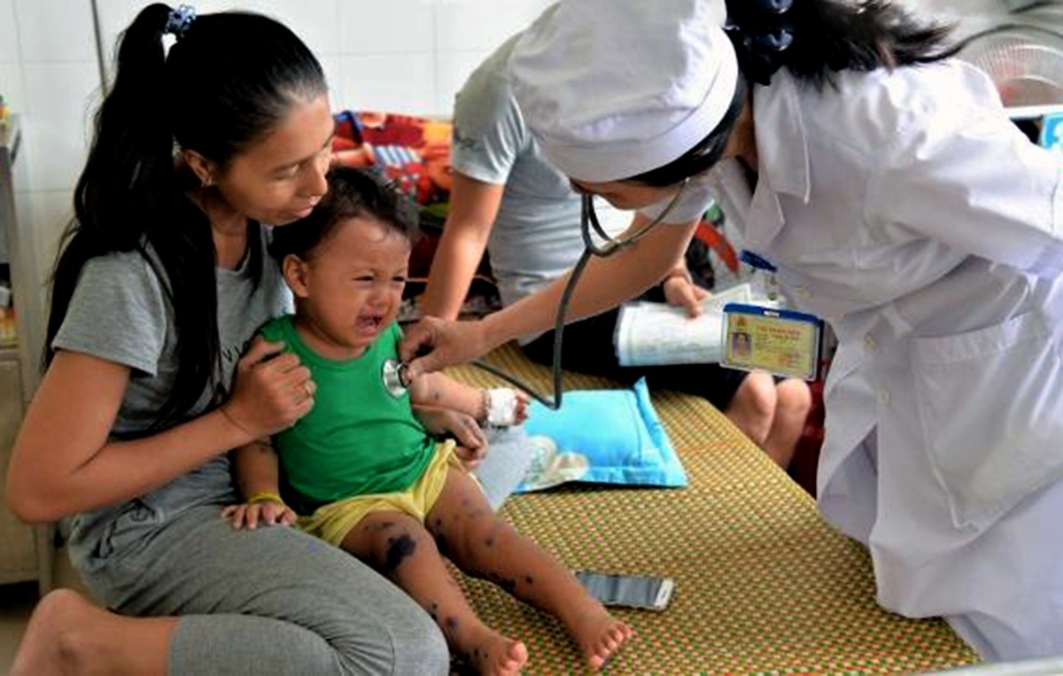 Bệnh tay chân miệng  ảnh 2 Benh tay chan mieng anh 2