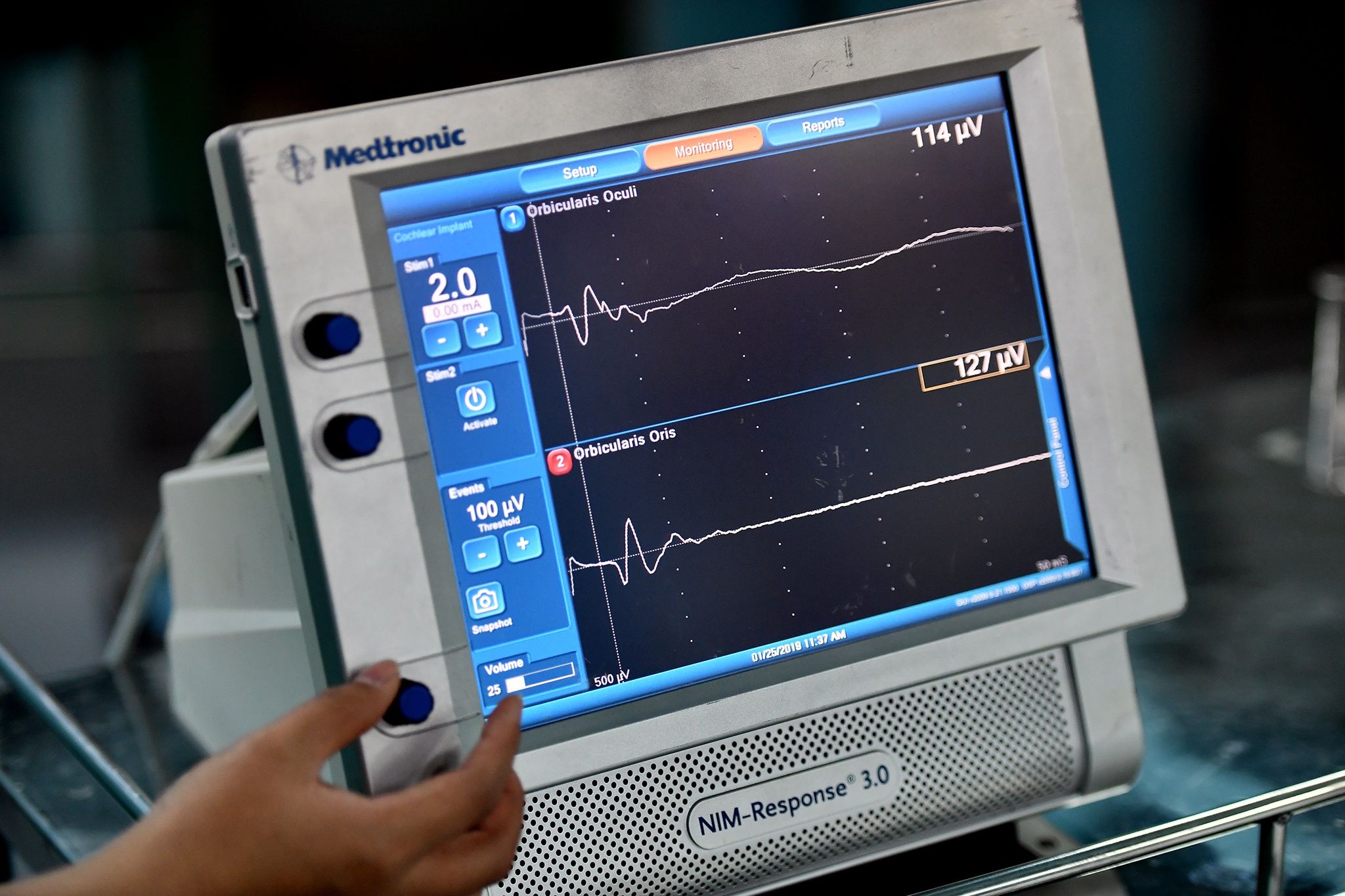 Ca phau thuat diec bam sinh anh 12