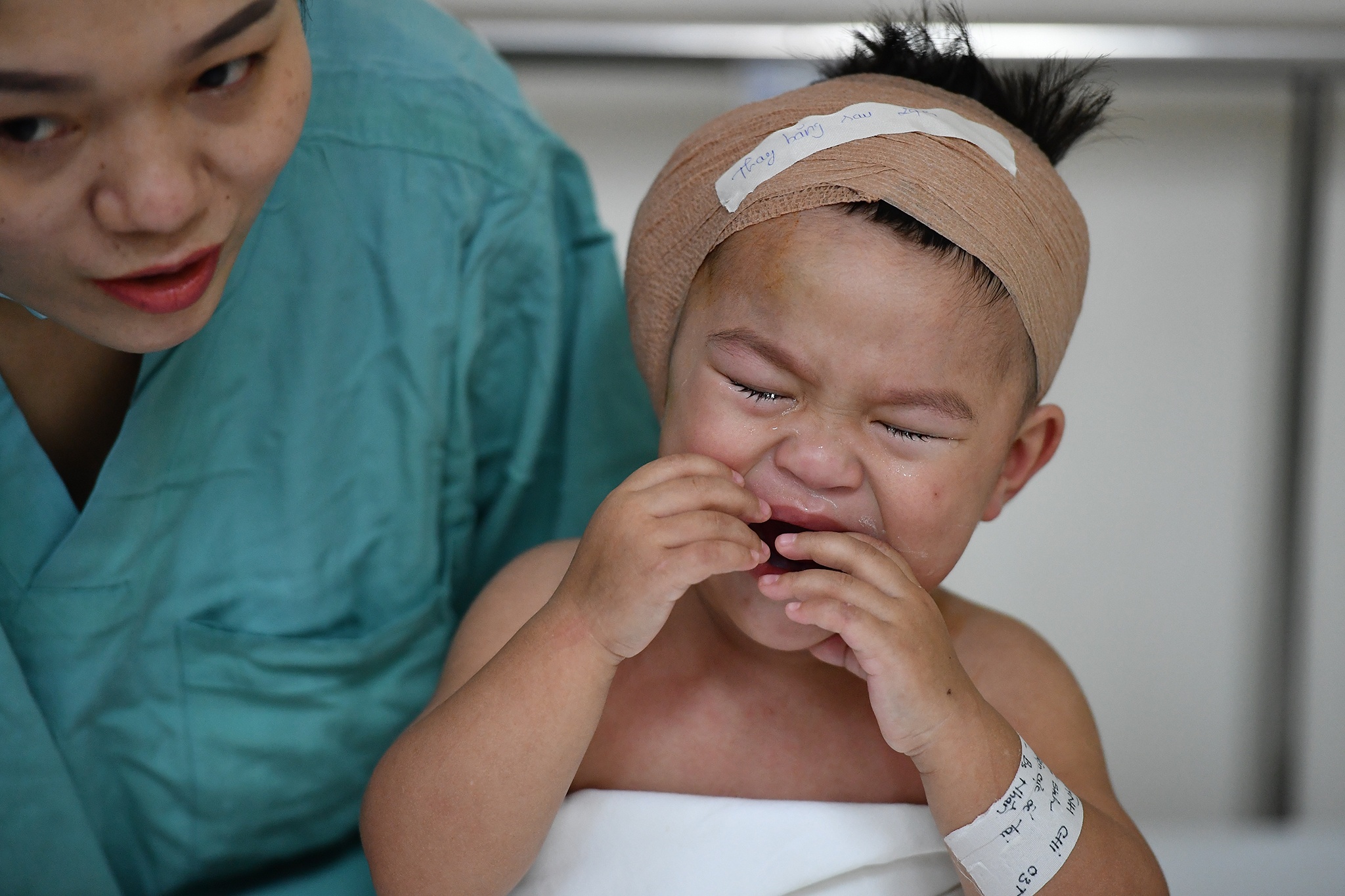 Ca phau thuat diec bam sinh anh 16