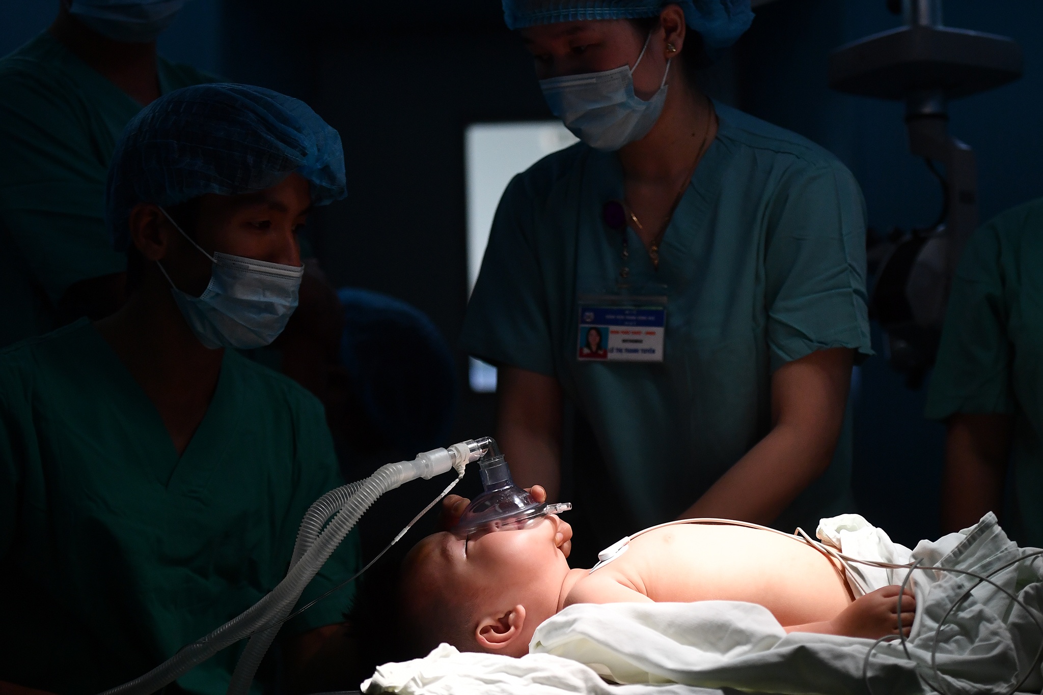 Ca phau thuat diec bam sinh anh 5