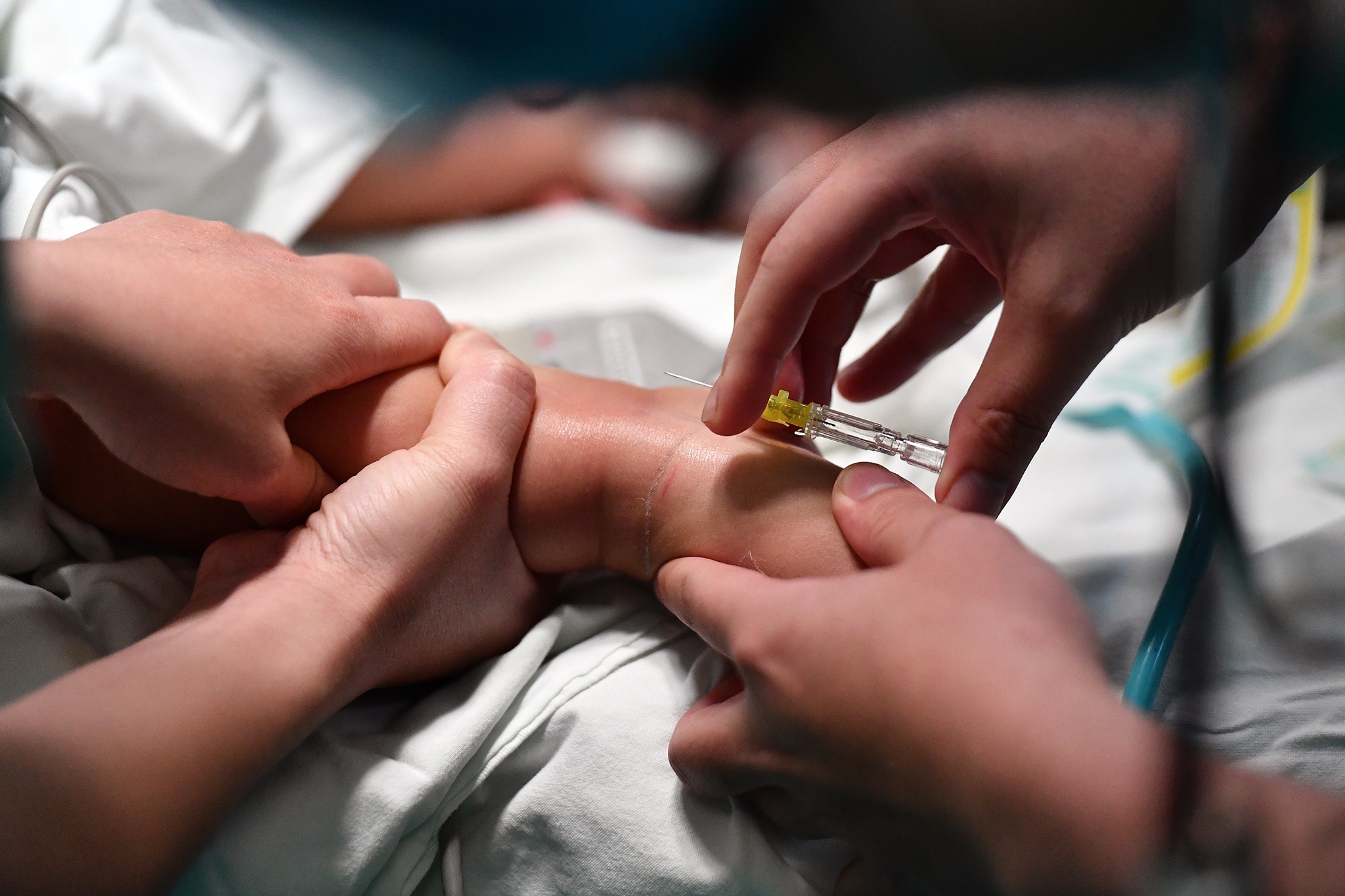 Ca phau thuat diec bam sinh anh 9