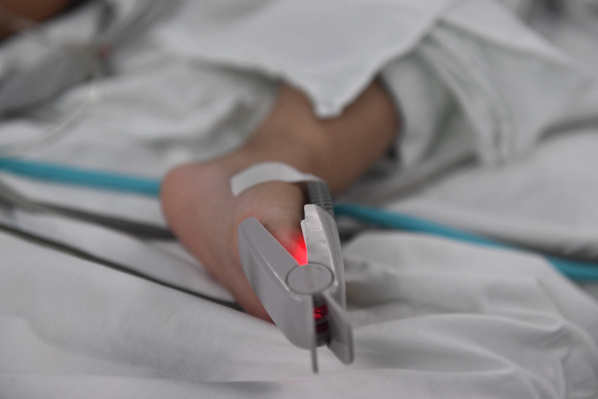 Ca phau thuat diec bam sinh anh 7