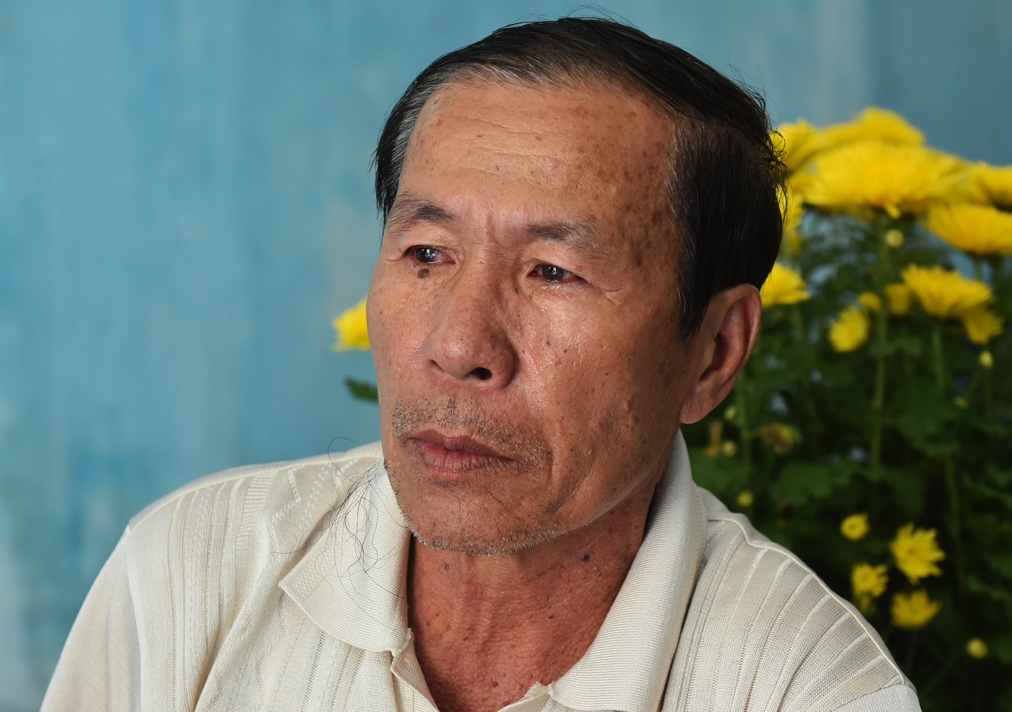 Viet kieu bi axit ngay Tet anh 1