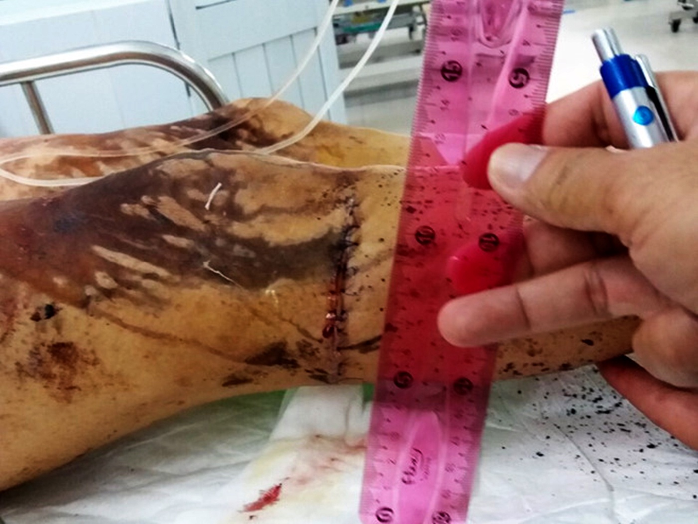 Vu tat axit nam Viet kieu anh 2