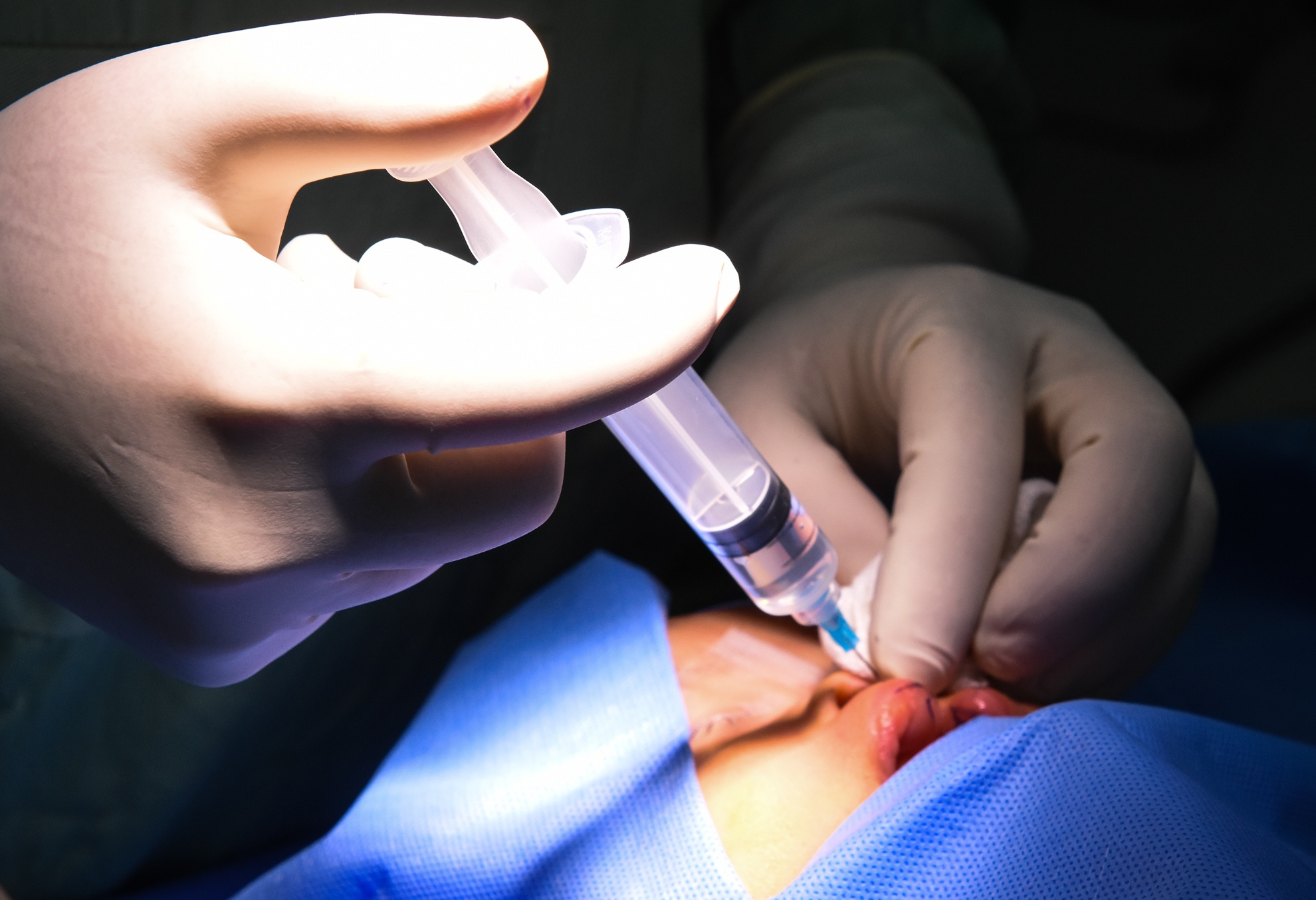 Phau thuat nu cuoi mien Trung anh 5