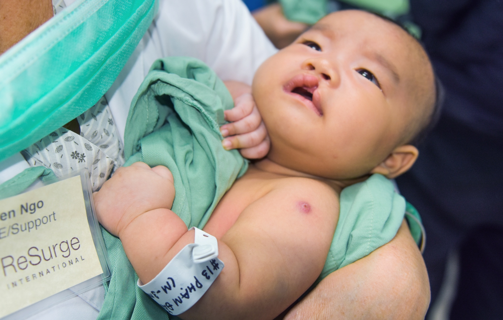 Phau thuat nu cuoi mien Trung anh 3