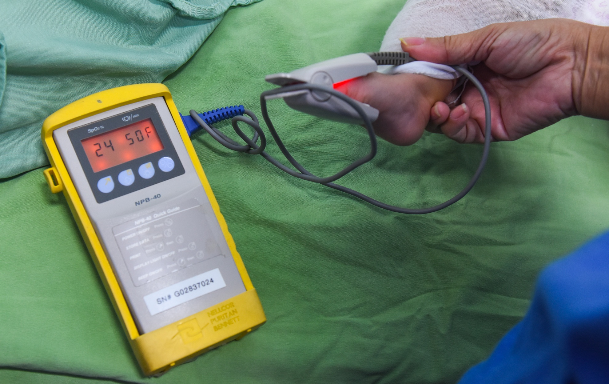 Phau thuat nu cuoi mien Trung anh 4