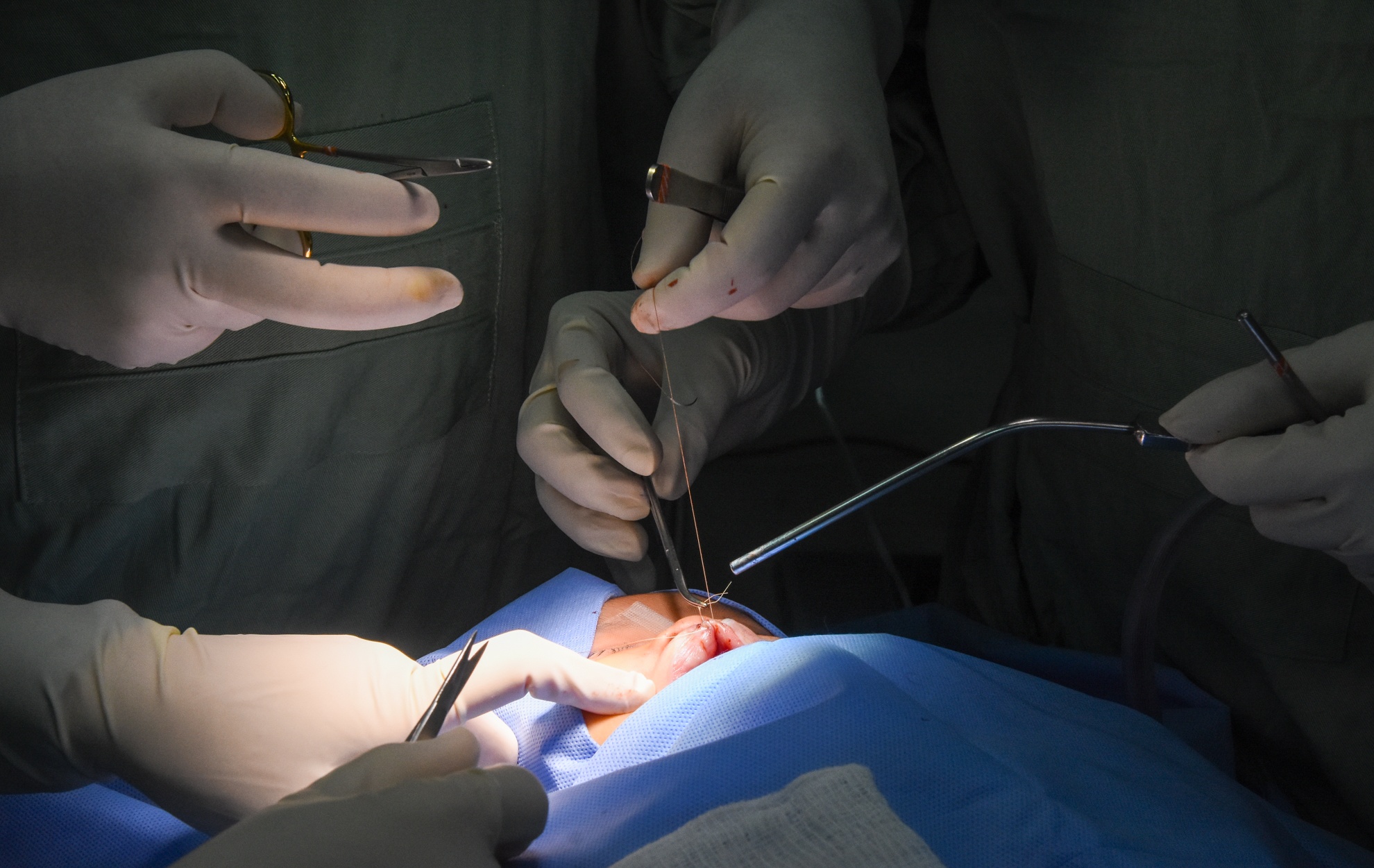 Can canh bac si My phau thuat cho tre sut moi o Viet Nam hinh anh