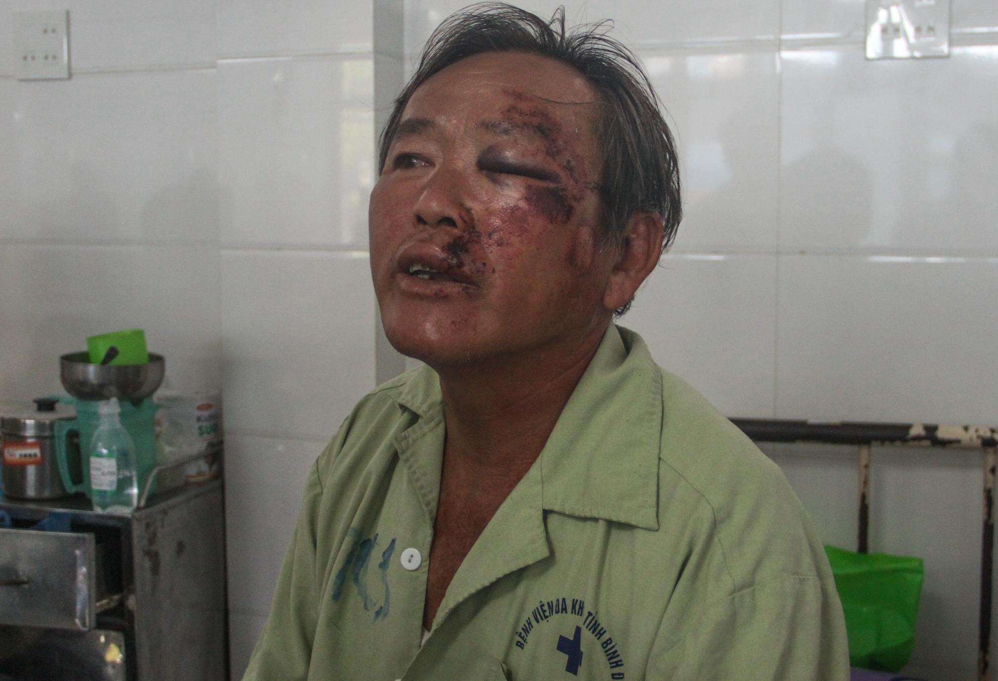 Xe lexus lao vao dam tang anh 1