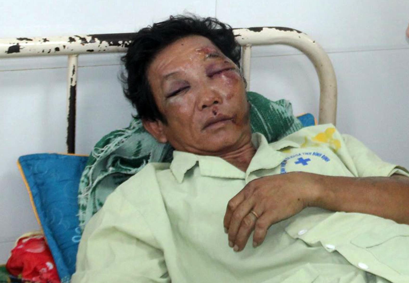 Nan nhan vu xe Lexus dam vao dam tang: 'Chung toi nghi minh da chet' hinh anh