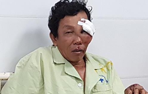 6 nan nhan bi thuong do Lexus bien 6666 tong da qua con nguy kich hinh anh