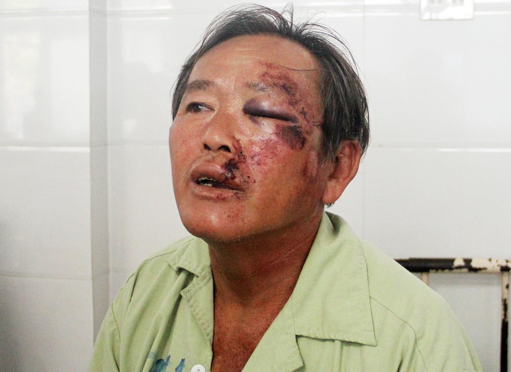 Xe Lexus lao vao dam tang anh 3