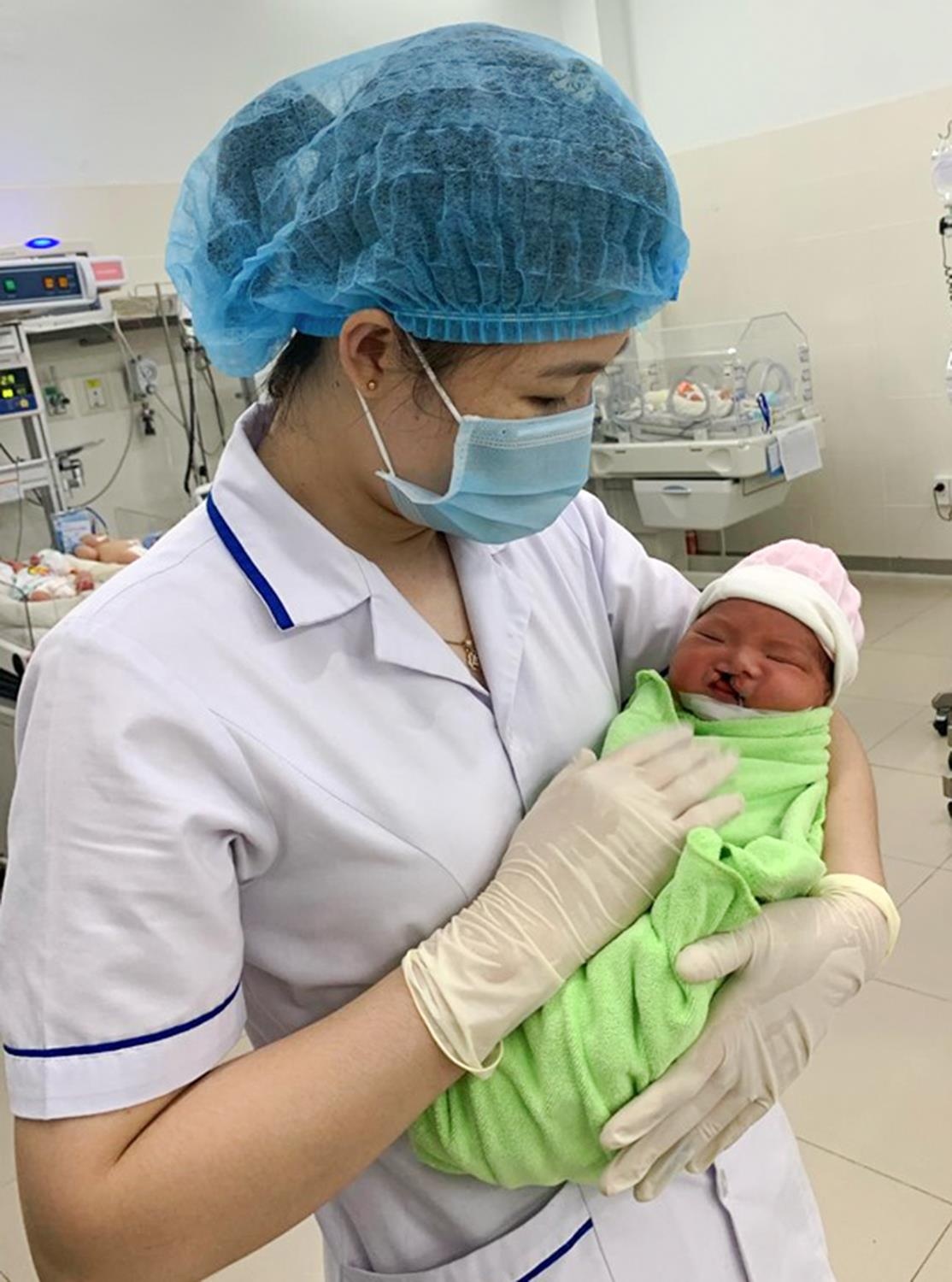 Trẻ sứt môi hở hàm ếch ảnh 2 Tre sut moi ho ham ech anh 2