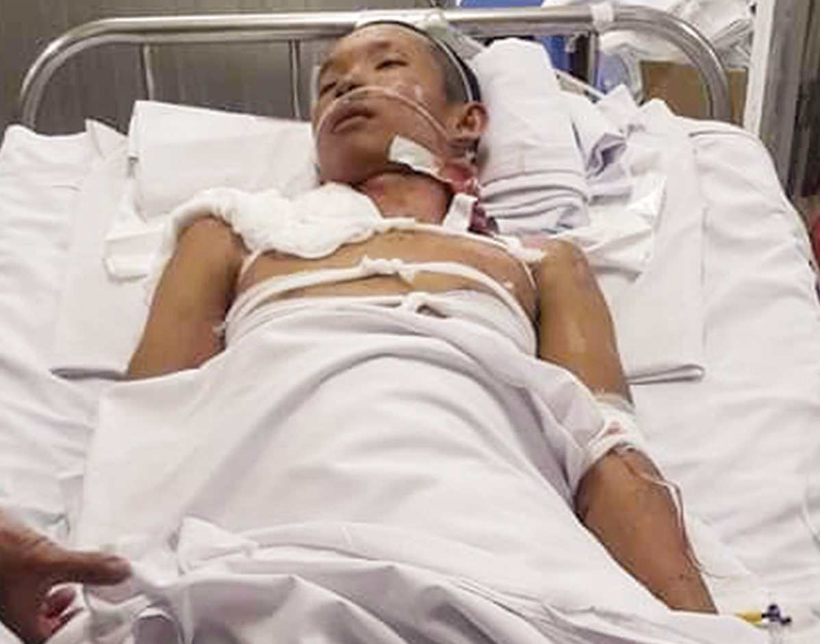 Nam thanh niên bị cưa chân  ảnh 1 Nam thanh nien bi cua chan anh 1