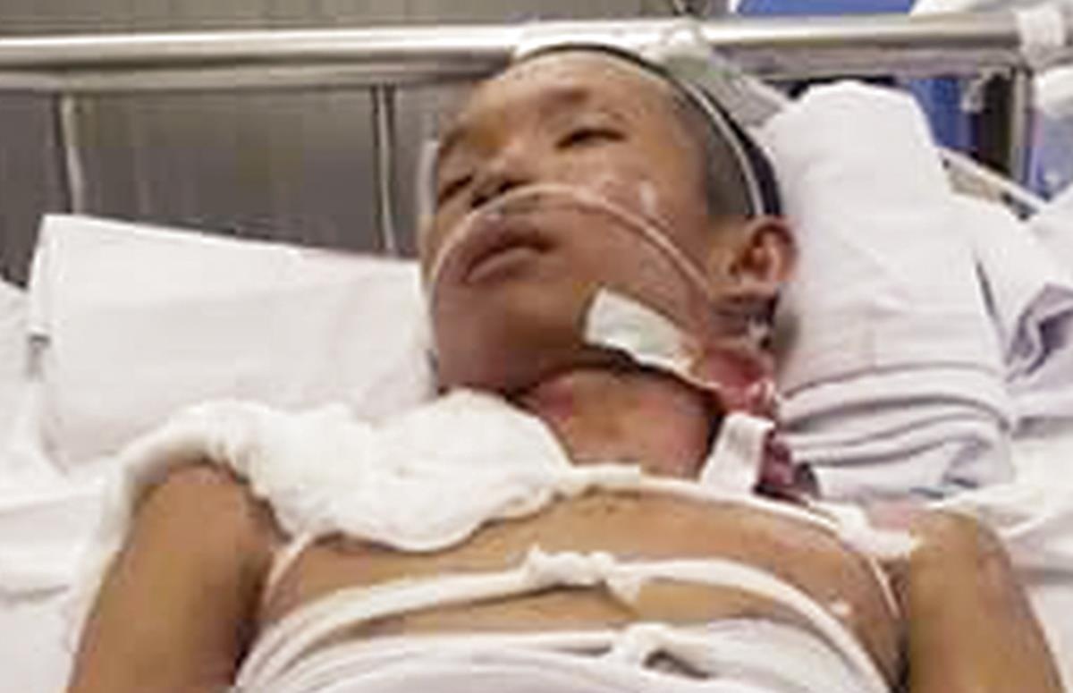 Tai nan lao dong, nam thanh nien 22 tuoi bi cua doi chan hinh anh