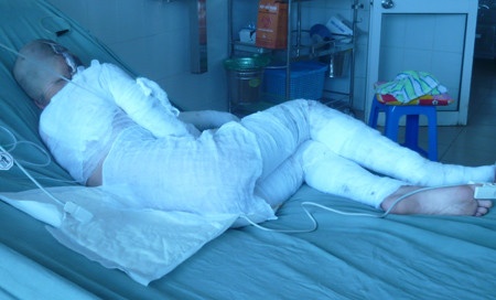 Doi khong duoc tien, tat ca can axit lam 2 nguoi chet hinh anh