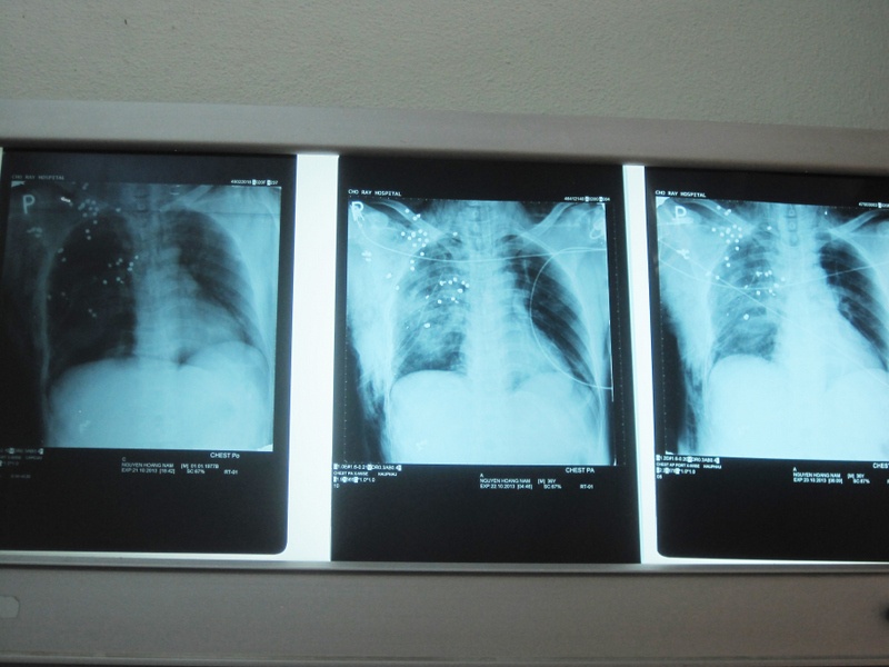 Tho san bi sung hoa cai cuop co ban nat xuong suon hinh anh