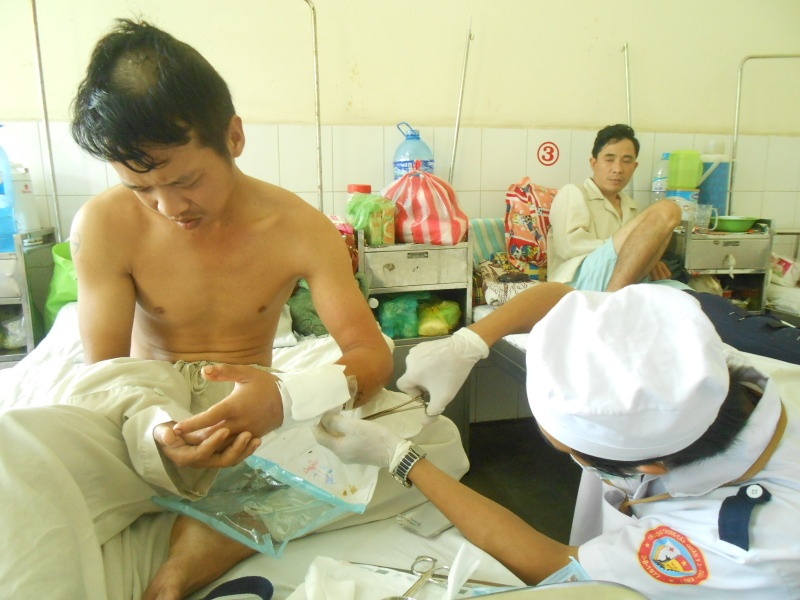 Giang ho Sai Gon chem dut lia canh tay mot cong nhan hinh anh